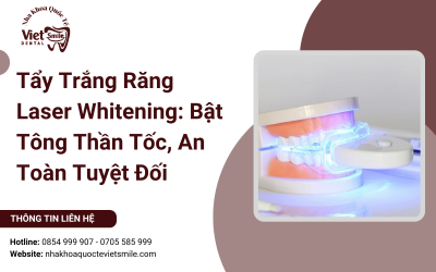 Tẩy Trắng Răng Laser Whitening: Bật Tông Thần Tốc, An Toàn Tuyệt Đối