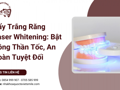 Tẩy Trắng Răng Laser Whitening: Bật Tông Thần Tốc, An Toàn Tuyệt Đối