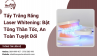 Tẩy Trắng Răng Laser Whitening: Bật Tông Thần Tốc, An Toàn Tuyệt Đối