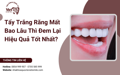 Tẩy Trắng Răng Mất Bao Lâu Thì Đem Lại Hiệu Quả Tốt Nhất?