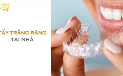 Những phương pháp tẩy trắng răng tại nhà hiệu quả bạn nên biết