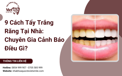 9 Cách Tẩy Trắng Răng Tại Nhà: Chuyên Gia Cảnh Báo Điều Gì?