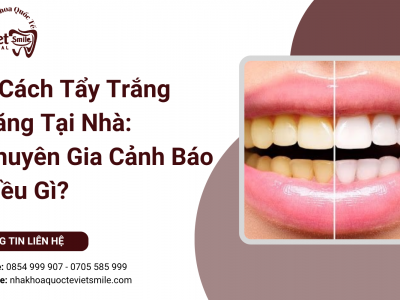 9 Cách Tẩy Trắng Răng Tại Nhà: Chuyên Gia Cảnh Báo Điều Gì?