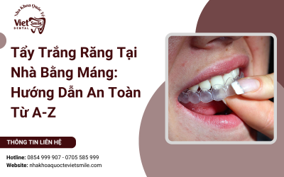 Tẩy Trắng Răng Tại Nhà Bằng Máng: Hướng Dẫn An Toàn Từ A-Z