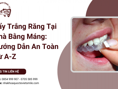 Tẩy Trắng Răng Tại Nhà Bằng Máng: Hướng Dẫn An Toàn Từ A-Z