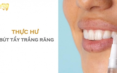 Thực hư bút tẩy trắng răng có làm trắng răng không?