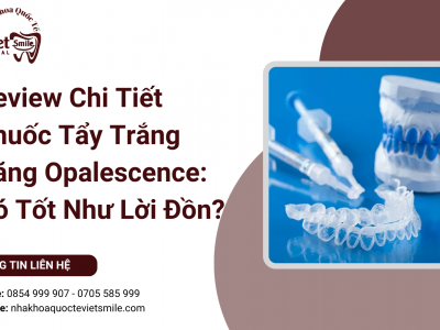 Review Chi Tiết Thuốc Tẩy Trắng Răng Opalescence: Có Tốt Như Lời Đồn?