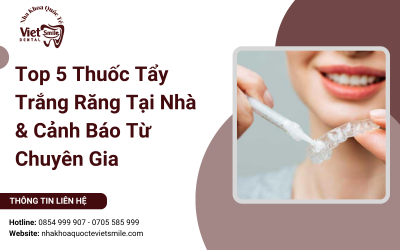 Top 5 Thuốc Tẩy Trắng Răng Tại Nhà & Cảnh Báo Từ Chuyên Gia