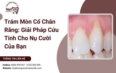 Trám Mòn Cổ Chân Răng: Giải Pháp Cứu Tinh Cho Nụ Cười Của Bạn