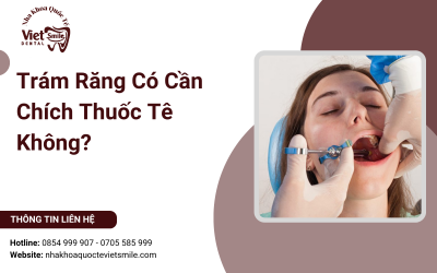 Trám Răng Có Cần Chích Thuốc Tê Không?