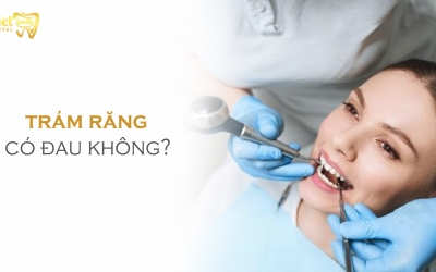 Trám răng có đau không? Trường hợp nào thì nên trám răng