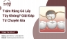Trám Răng Có Lấy Tủy Không? Giải Đáp Từ Chuyên Gia