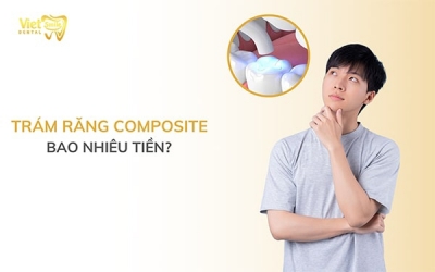 Trám răng composite bao nhiêu tiền?