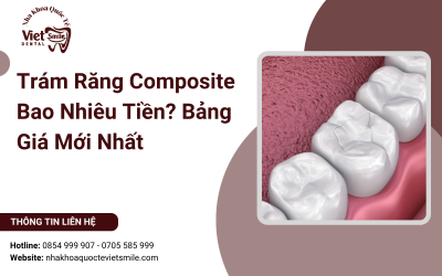 Trám Răng Composite Bao Nhiêu Tiền? Bảng Giá Mới Nhất 2025