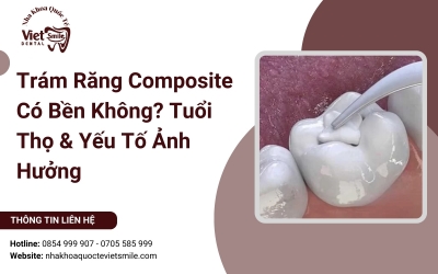 Trám Răng Composite Có Bền Không? Tuổi Thọ & Yếu Tố Ảnh Hưởng