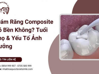 Trám Răng Composite Có Bền Không? Tuổi Thọ & Yếu Tố Ảnh Hưởng