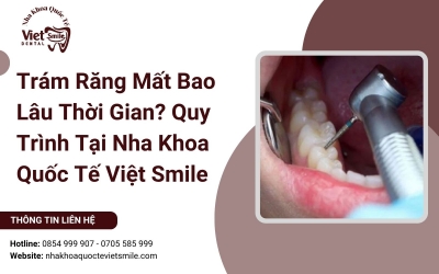 Trám Răng Mất Bao Lâu Thời Gian? Quy Trình Tại Nha Khoa Quốc Tế Việt Smile