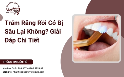 Trám Răng Rồi Có Bị Sâu Lại Không? Giải Đáp Chi Tiết
