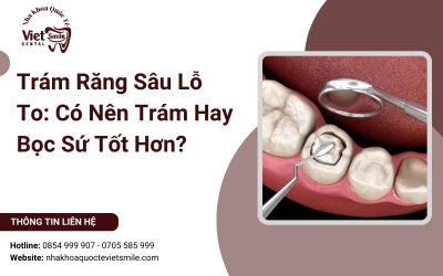Trám Răng Sâu Lỗ To: Có Nên Trám Hay Bọc Sứ Tốt Hơn?