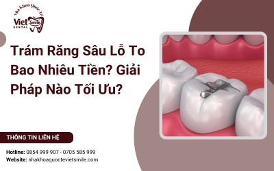 Trám Răng Sâu Lỗ To Bao Nhiêu Tiền? Giải Pháp Nào Tối Ưu?