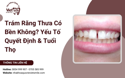 Trám Răng Thưa Có Bền Không? Yếu Tố Quyết Định & Tuổi Thọ