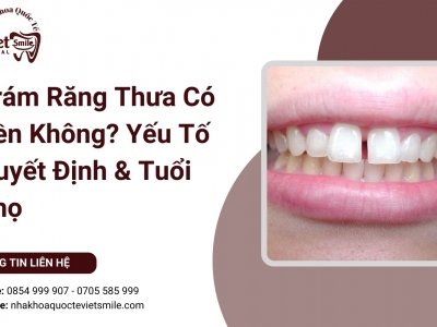 Trám Răng Thưa Có Bền Không? Yếu Tố Quyết Định & Tuổi Thọ