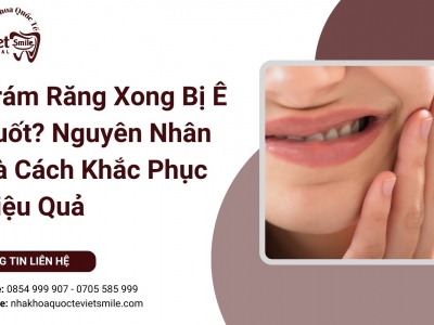 Trám Răng Xong Bị Ê Buốt? Nguyên Nhân Và Cách Khắc Phục Hiệu Quả