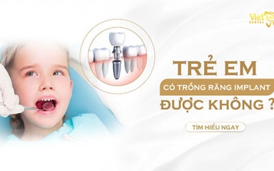 Trẻ em có trồng răng implant được không?