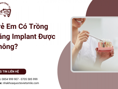 Trẻ Em Có Trồng Răng Implant Được Không?