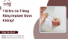 Trẻ Em Có Trồng Răng Implant Được Không?