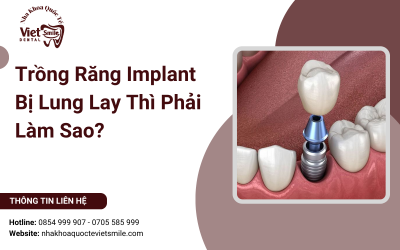Trồng Răng Implant Bị Lung Lay Thì Phải Làm Sao?