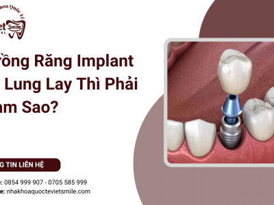 Trồng Răng Implant Bị Lung Lay Thì Phải Làm Sao?