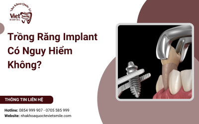 Trồng Răng Implant Có Nguy Hiểm Không?