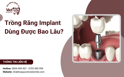 Trồng Răng Implant Dùng Được Bao Lâu?