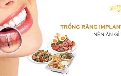 Mới trồng răng Implant nên ăn gì? Gợi ý 3 bữa ăn chính cho người mới trồng răng