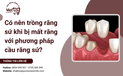 Có nên trồng răng sứ khi bị mất răng với phương pháp cầu răng sứ?