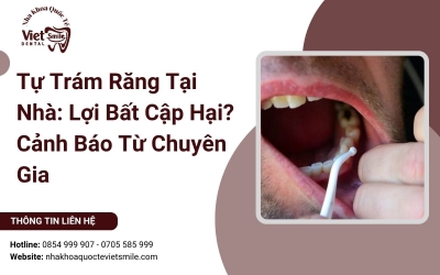 Tự Trám Răng Tại Nhà: Lợi Bất Cập Hại? Cảnh Báo Từ Chuyên Gia