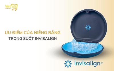 Ưu điểm của niềng răng trong suốt invisalign