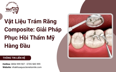 Vật Liệu Trám Răng Composite: Giải Pháp Phục Hồi Thẩm Mỹ Hàng Đầu