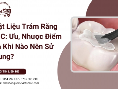 Vật Liệu Trám Răng GIC: Ưu, Nhược Điểm và Khi Nào Nên Sử Dụng?