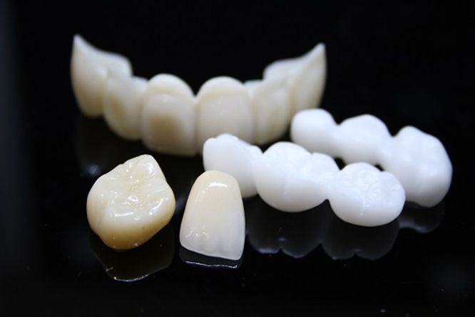 Nên bọc răng sứ loại nào? Top 6 Răng Sứ Tốt Nhất Hiện Nay