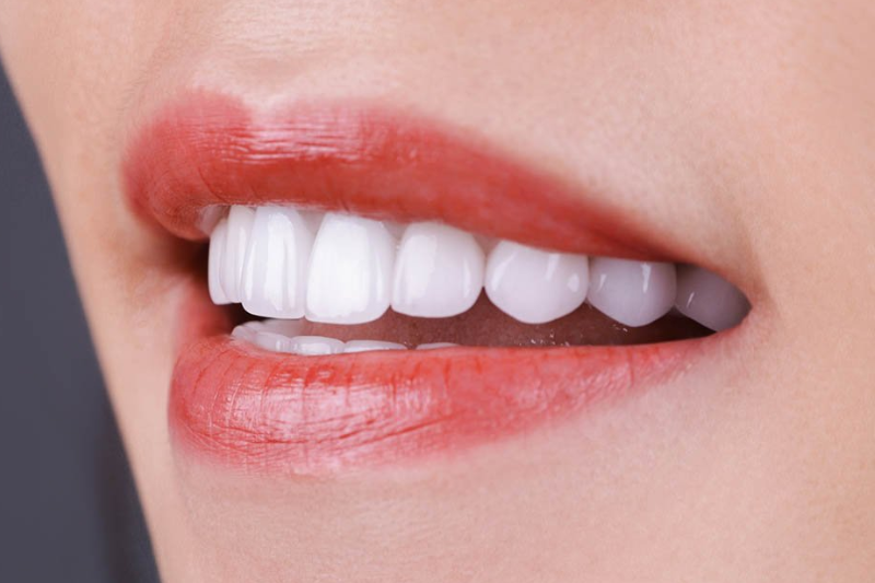 Bọc răng sứ loại nào tốt nhất hiện nay? - Nha Khoa An Phước