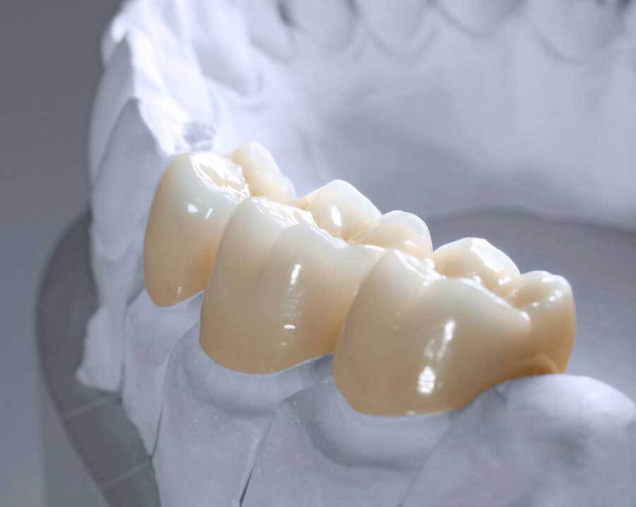 BỌC RĂNG SỨ ĐÀ NẴNG Ở ĐÂU UY TÍN? TOP 7 NHA KHOA ĐÀ NẴNG BỌC SỨ TỐT - Nha Khoa No1 Đà Nẵng