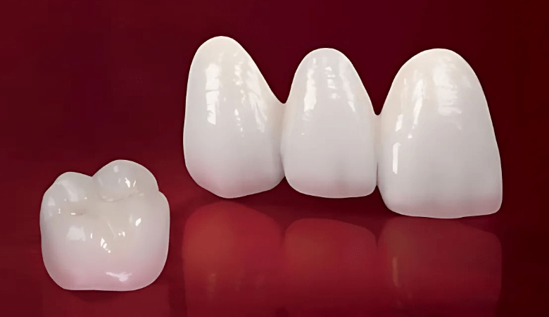 Răng toàn sứ là gì? Có mấy loại và giá bao nhiêu?