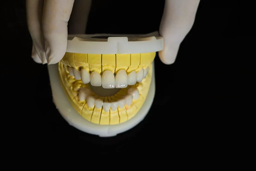 Các loại răng sứ tốt nhất hiện nay? Ưu và nhược điểm