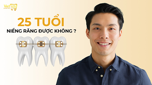 25 tuổi niềng răng được không? Giải đáp từ chuyên gia