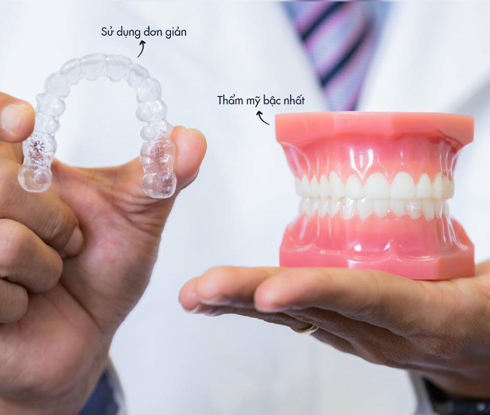 Niềng răng trong suốt Invisalign