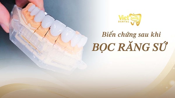 Nguyên nhân gây ra những biến chứng sau khi bọc răng sứ