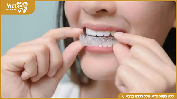 Bộ khay niềng răng Invisalign 