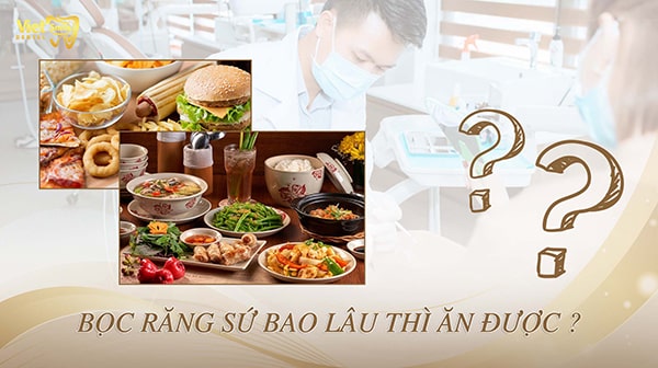 Bọc răng sứ bao lâu thì ăn được bình thường? Cách chăm sóc răng miệng sau khi bọc răng sứ